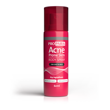 Acne Body Spray 60ml for Chest and Back with 2% Salicylic Acid